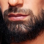 Implanted beard +120&nbsp;&euro;